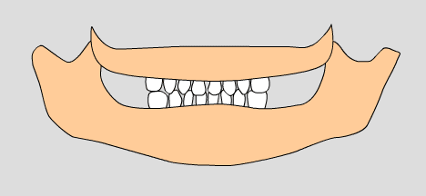 illustration of baby teeth, 14-19 months