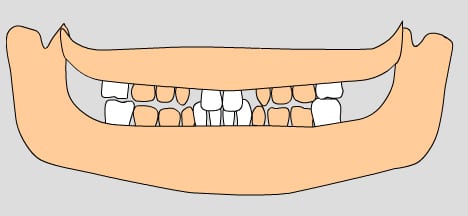 illustration of permanent teeth, 7-8 years